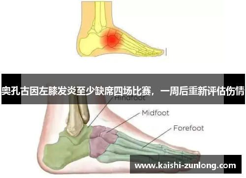 奥孔古因左膝发炎至少缺席四场比赛，一周后重新评估伤情